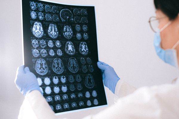 Speranţă în lupta cu Alzheimer - un compus pe bază de cupru